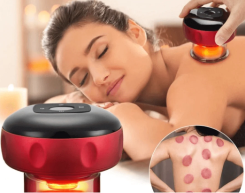 SmartMassage™ Vacuum Cupping