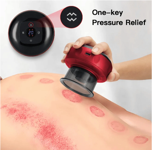 SmartMassage™ Vacuum Cupping